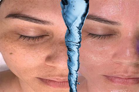 Hydrafacial Solüsyonları Nasıl Kullanılır? Adım Adım Rehber Hydrafacial Solüsyonları Nasıl Kullanılır? Adım Adım Rehber