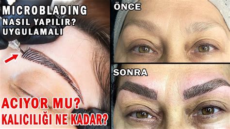 Microblading Sildirme: İşlem Nasıl Yapılır ve Riskleri Nelerdir? Microblading Sildirme: İşlem Nasıl Yapılır ve Riskleri Nelerdir?
