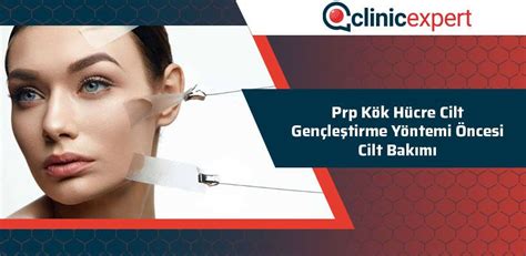 Karbon Peeling Öncesi ve Sonrası Karbon Peeling Öncesi ve Sonrası