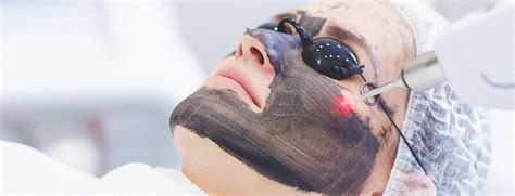 Lazerle Karbon Peeling Yaptıranların yorumları Lazerle Karbon Peeling Yaptıranların yorumları